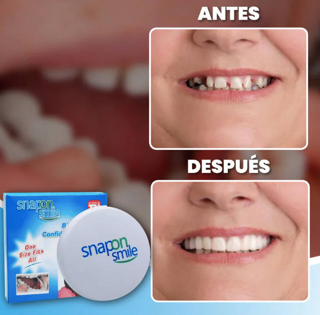 2X1 Carillas Dentales Premium - HappySmile 🦷