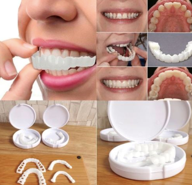 2X1 Carillas Dentales Premium - HappySmile 🦷